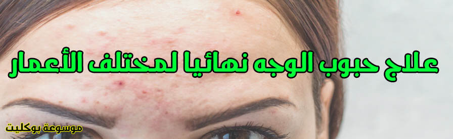 علاج حبوب الوجه نهائيا لمختلف الأعمار (علاج شامل)